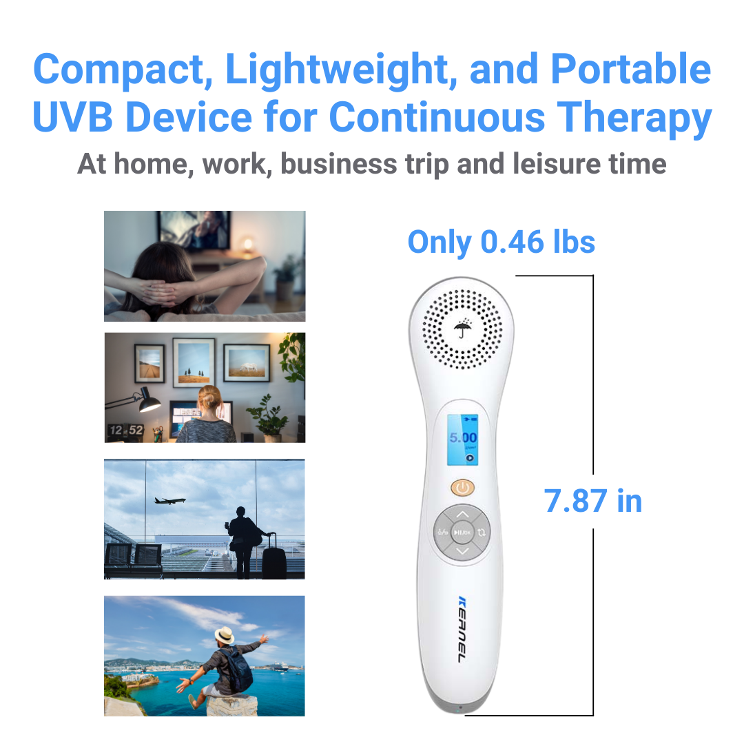 Portable 308nm Excimer LED Light for Psoriasis, Vitiligo & Eczema