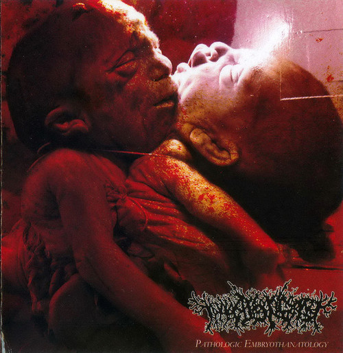 THANATOPSIS - "Pathologic Embryothanatology" CD