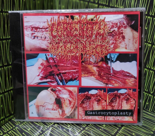 CONGENITAL INTERIOR DEFECTS - "Gastrocytoplasty" CD-R (Reissue)