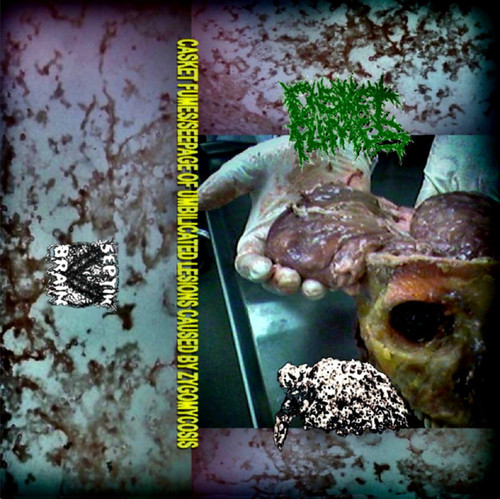 SEEPAGE OF UMBILICATED LESIONS CAUSED BY ZYGOMYSCOSIS / CASKET FUMES - Split TAPE SEEPAGE OF UMBILICATED LESIONS CAUSED BY ZYGOMYSCOSIS / CASKET FUMES - Split TAPE