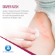 Infographic illustrating gentle application of Dynarex Zinc Oxide Ointment for the treatment and prevention of diaper rash.