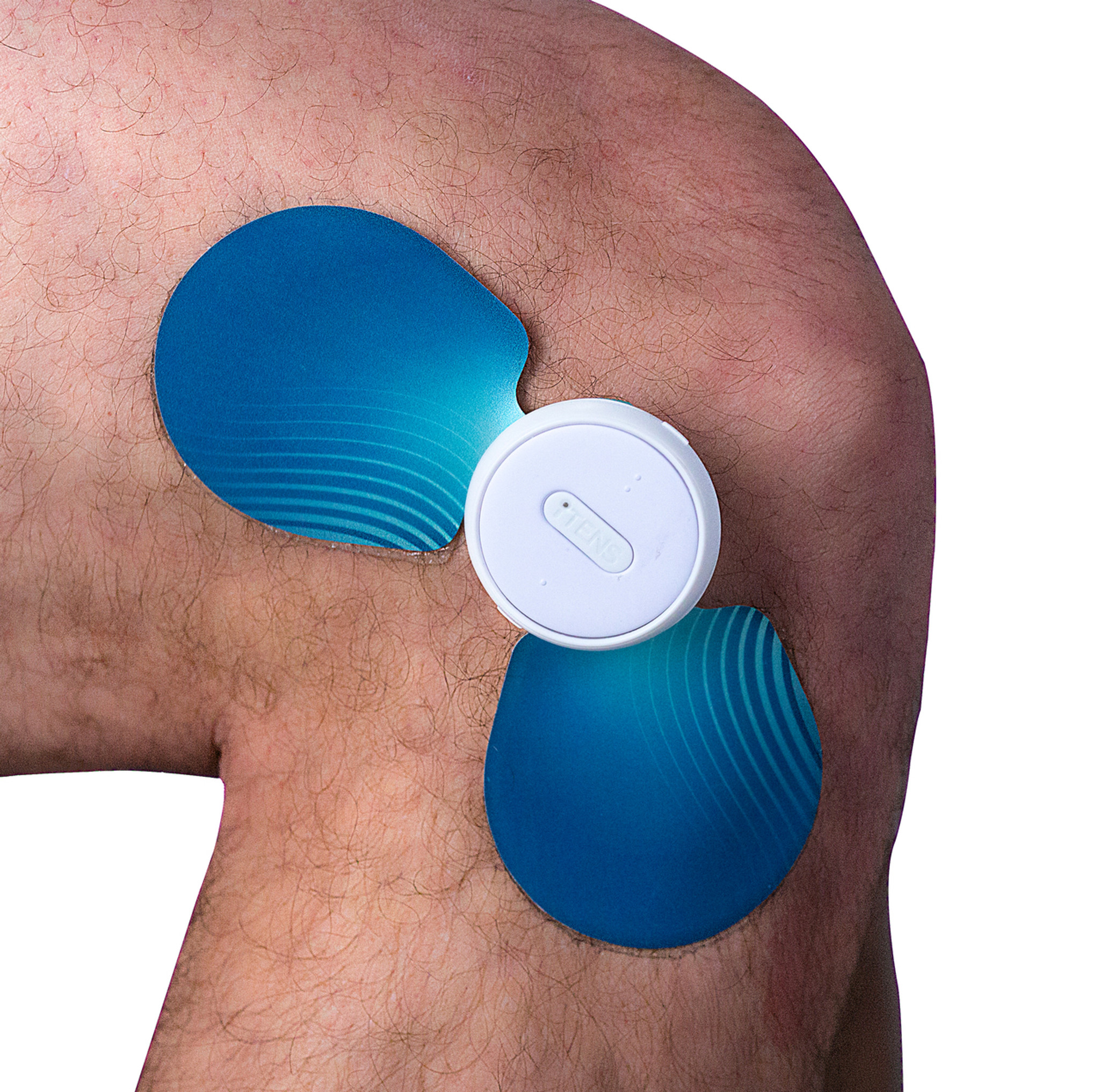 Wireless TENS Unit Stimulator by iTENS – Bluetooth Enabled TENS Device with  Free App, for Back Pain, Knee Pain, and Other Joint Relief. Rechargeable
