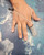 The Sinker Guy Finger Protector, a medical device fitted on a person's finger to prevent injury during activities.