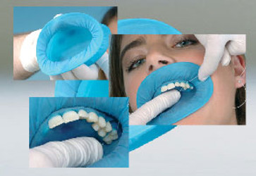 OptraDam Plus Rubber Dam Refill, Anatomically Shaped 3-Dimensional, Small Size