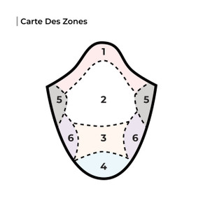 Prothèse Capillaire en dentelle pour Homme sur Mesure