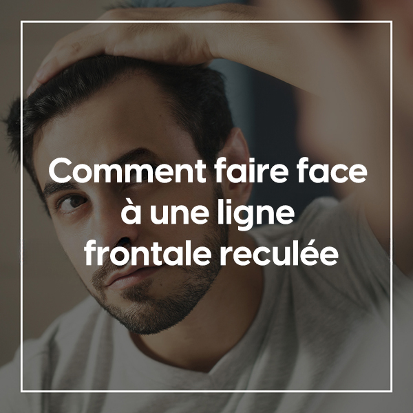 Comment faire face à une ligne frontale reculée