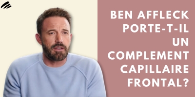 Ben Affleck Porte-T-Il Un Complement Capillaire Frontal?