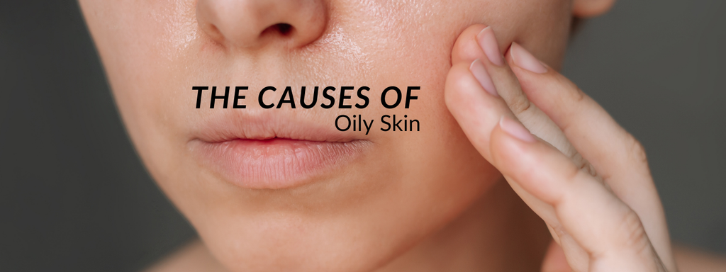 What Causes Oily Skin