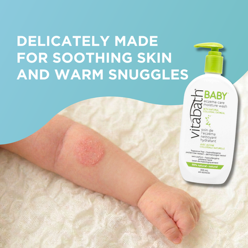 BABY Eczema Care Moisture Wash 355 mL