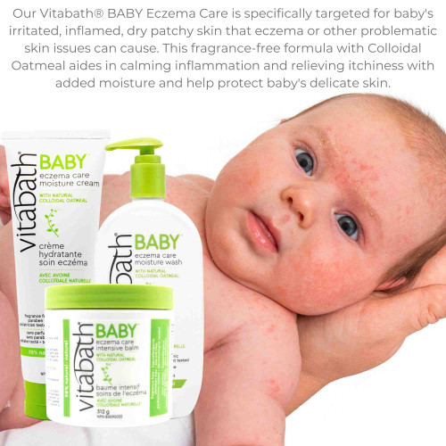 BABY  Eczema Care Moisture Cream 226 g