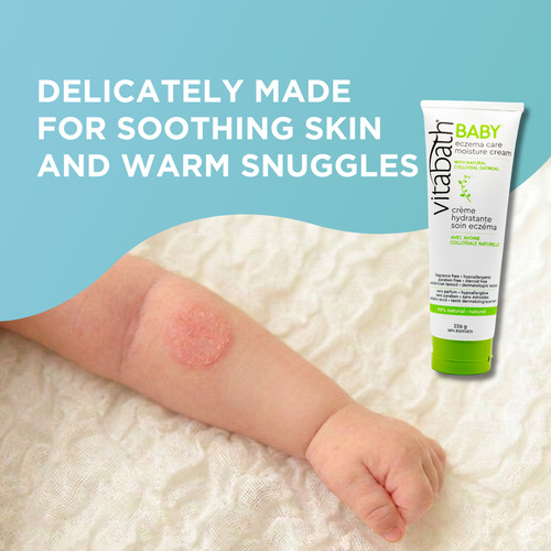 BABY  Eczema Care Moisture Cream 226 g