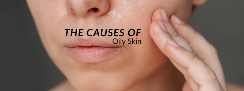 What Causes Oily Skin