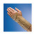 Rolyan AlignRite Enlarged Wrist Support