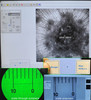 Nikon Eclipse Ti-E Inverted Research Microscope, ASI Stage+SOLA Epi Light Engine