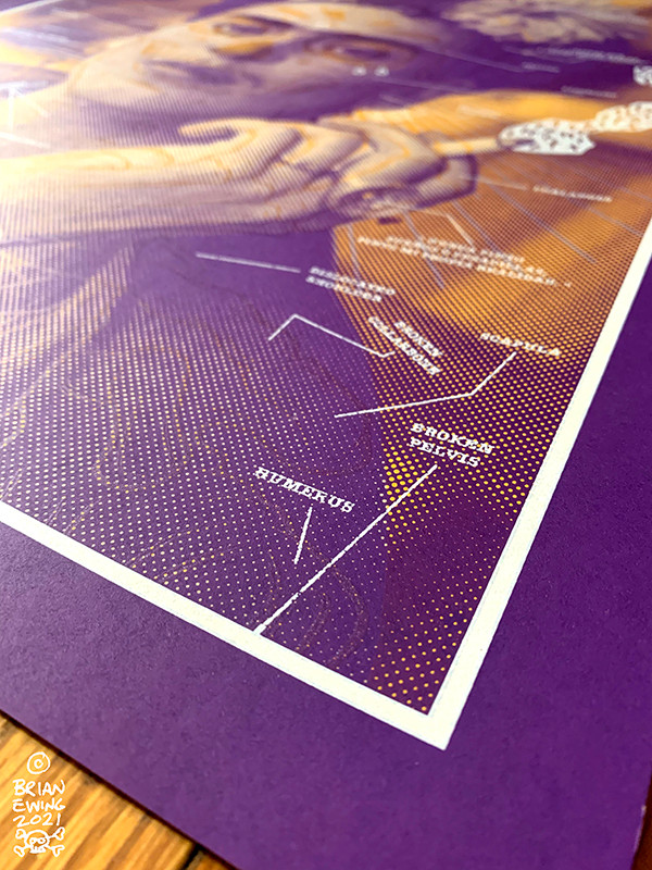 FRIDA: LAKERS VARIANT