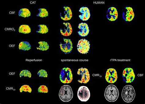 neuro.jpg