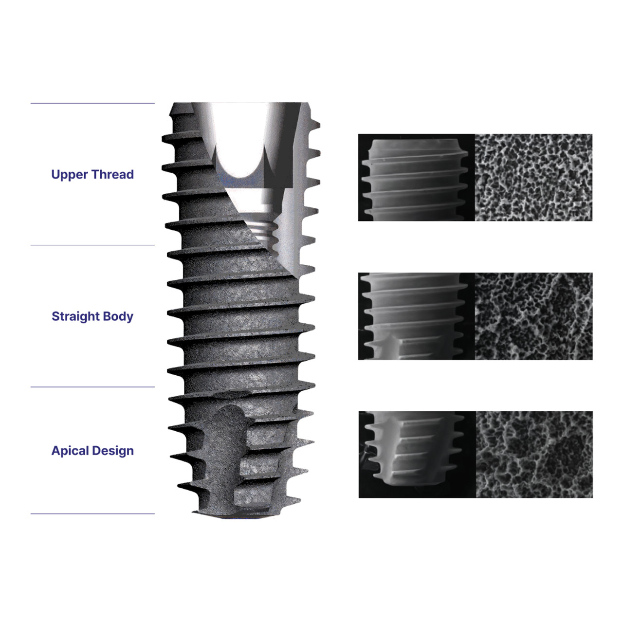 DIO UF(ll) Fixture, Narrow