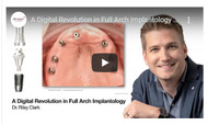 A Digital Revolution in Full Arch Implantology 