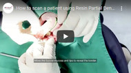 How to scan a patient using RPD