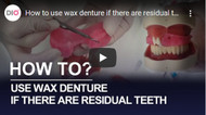 How to use wax denture if there are residual teeth