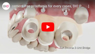 Cement-free prosthesis for every cases, DIO Prosthetic Solutions