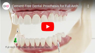 Cement-Free Dental Prosthesis for Full Arch