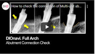 How to check the connection of Multi-unit abutment and temporary cylinder