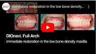 Restorative process of the fixture that has low stability