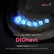 600K implants placed with DIOnavi.