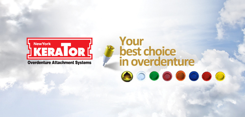 What is Kerator locator abutment Whitecap Dental Solution