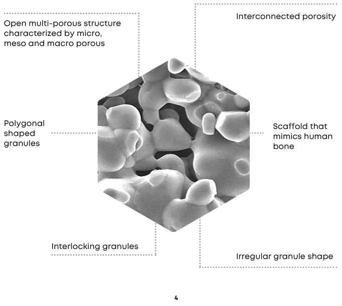 CERASORB M granule structure diagram showing interconnected porosity and irregular, interlocking granules