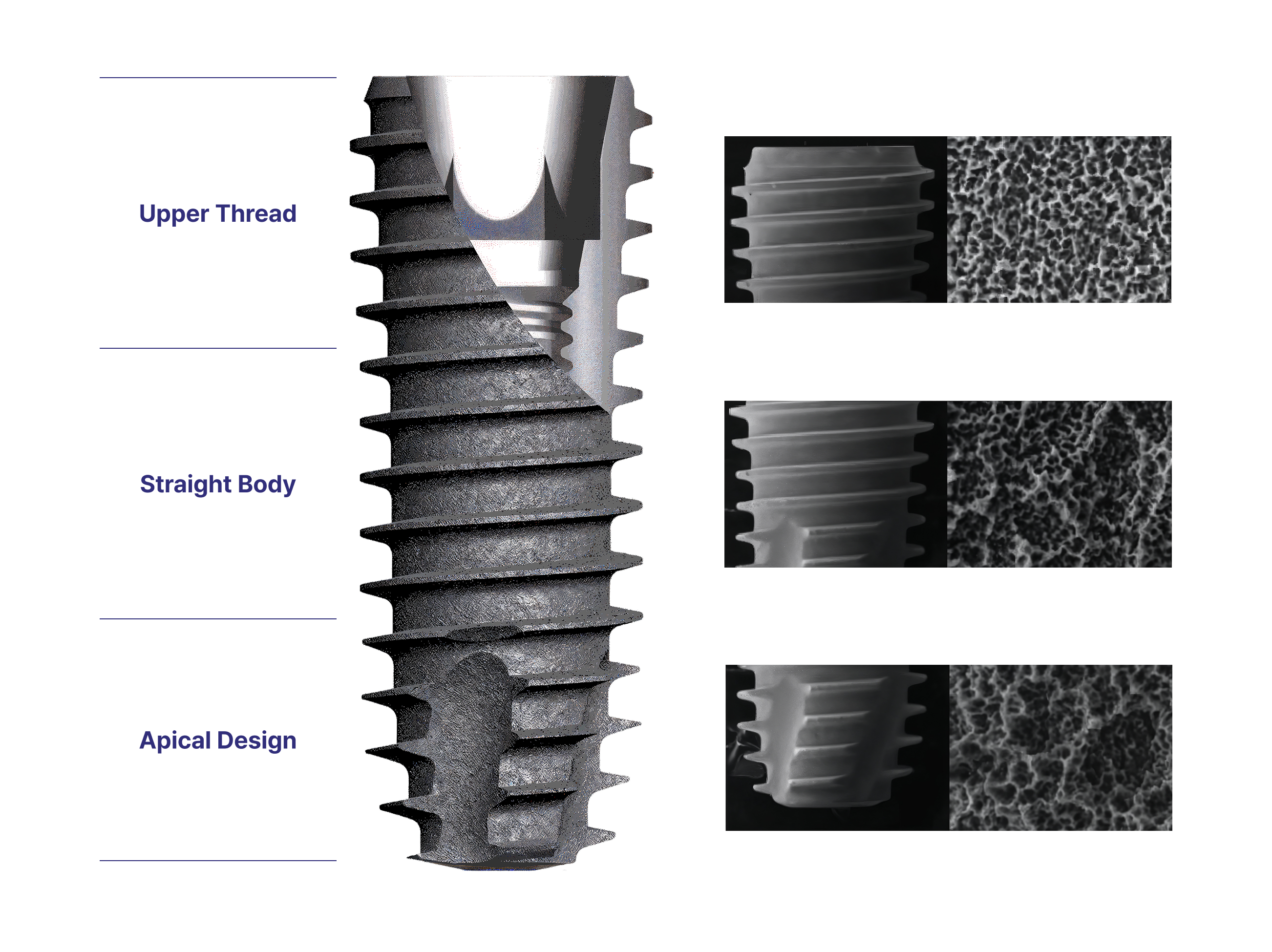 Different segments of DIO UF(ll) Fixture, Regular.