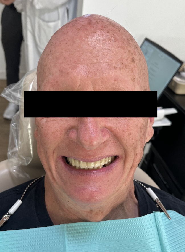 Facial photo example front smile