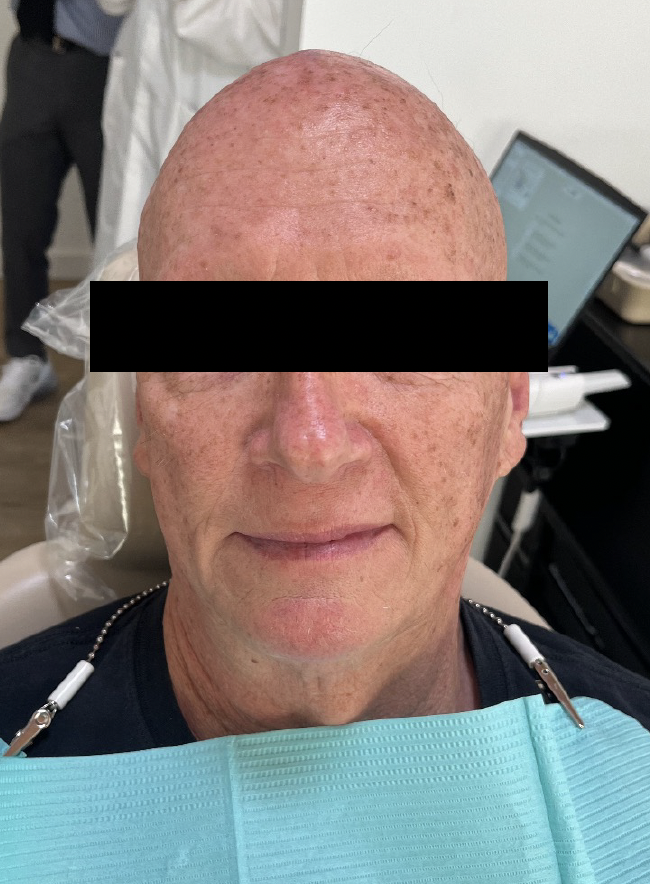 Facial photo example front view
