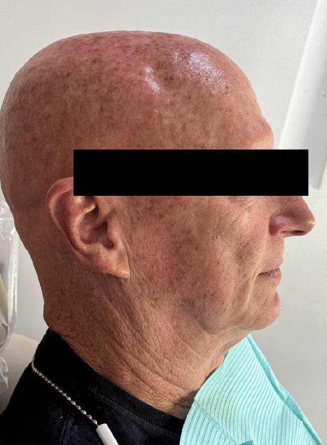 Facial photo example lateral profile