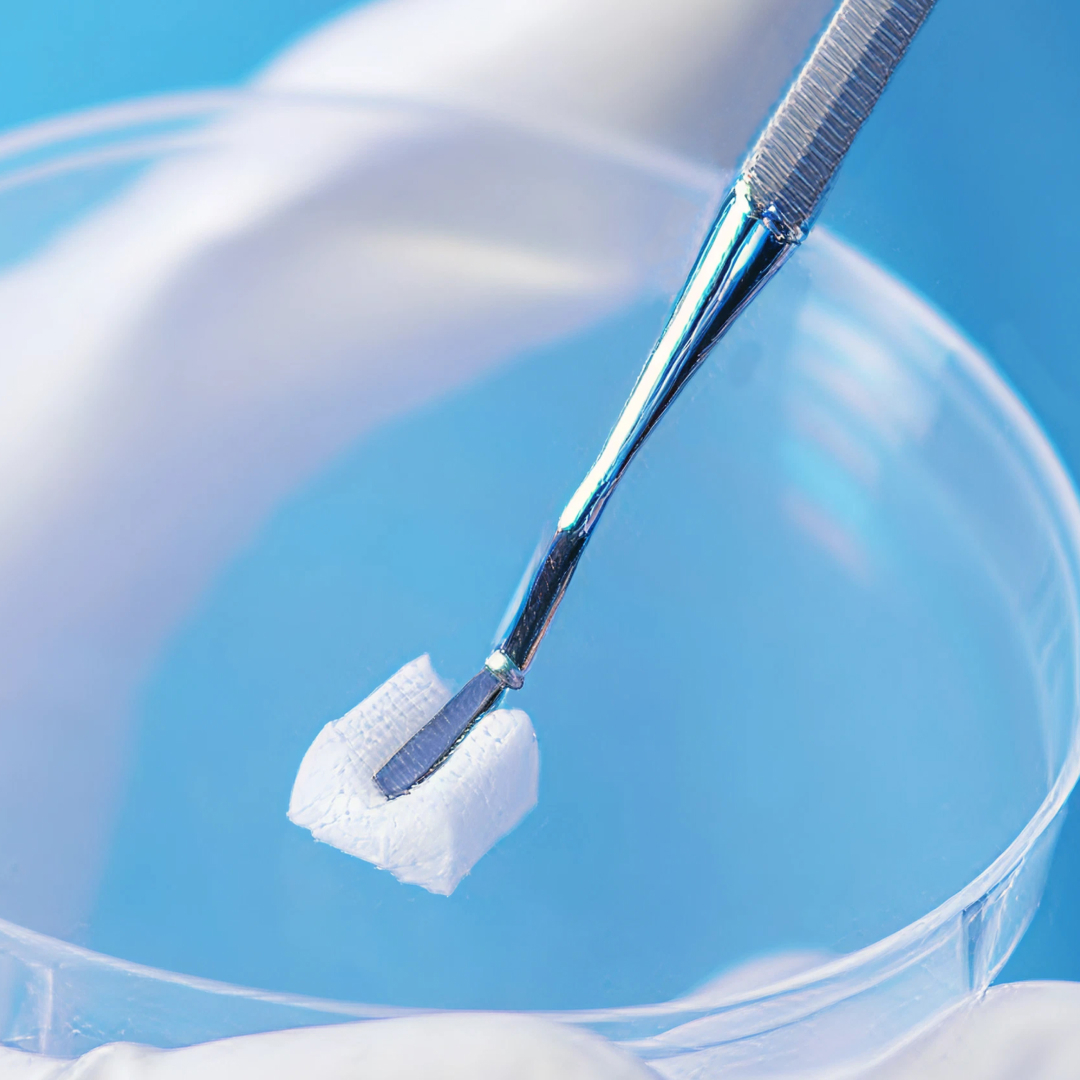 The Bio-Oss Collagen is being used.