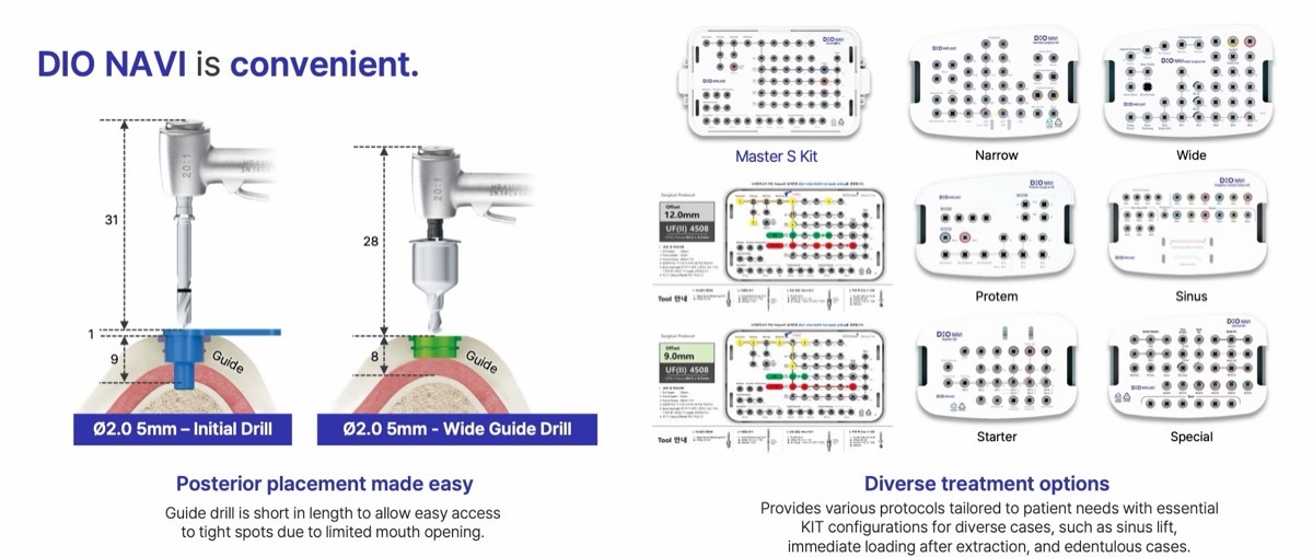 DIO NAVI convenience: short guide drill and kit options