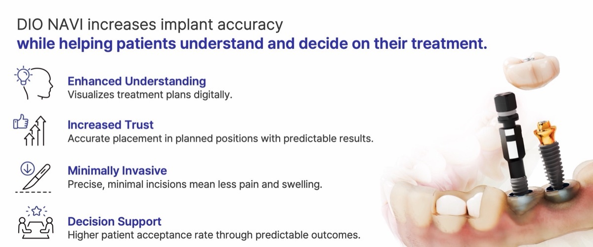 DIO NAVI: enhanced understanding, increased trust, minimally invasive, decision support
