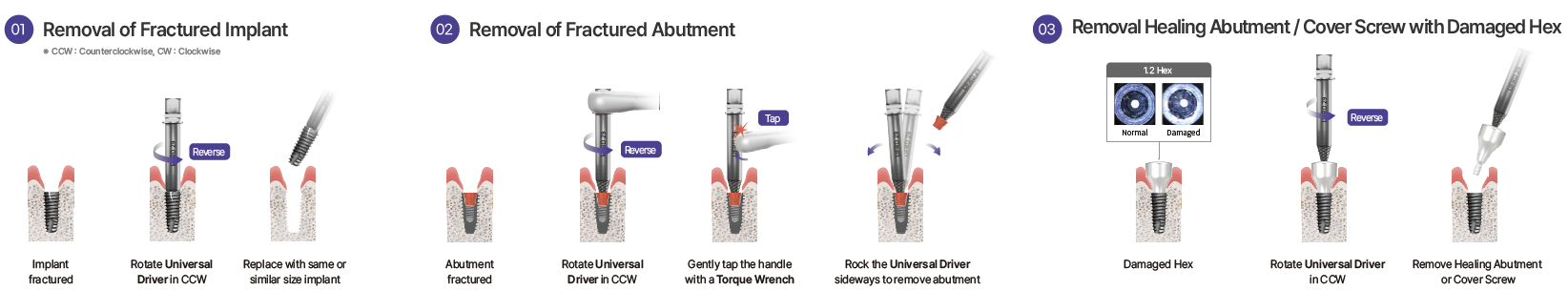 Dr. SOS Plus fractured implant and abutment removal protocols