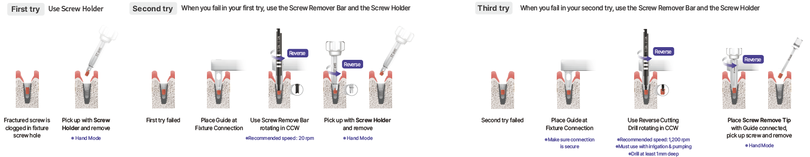 Fractured dental implant abutment screw removal protocol