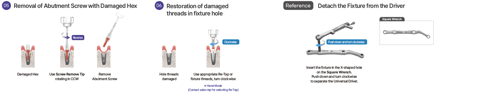 Damaged implant hex removal and internal thread restoration protocol