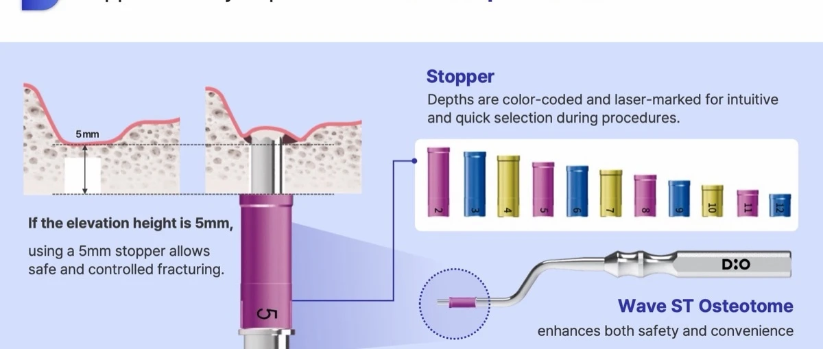 Color-coded osteotome stoppers