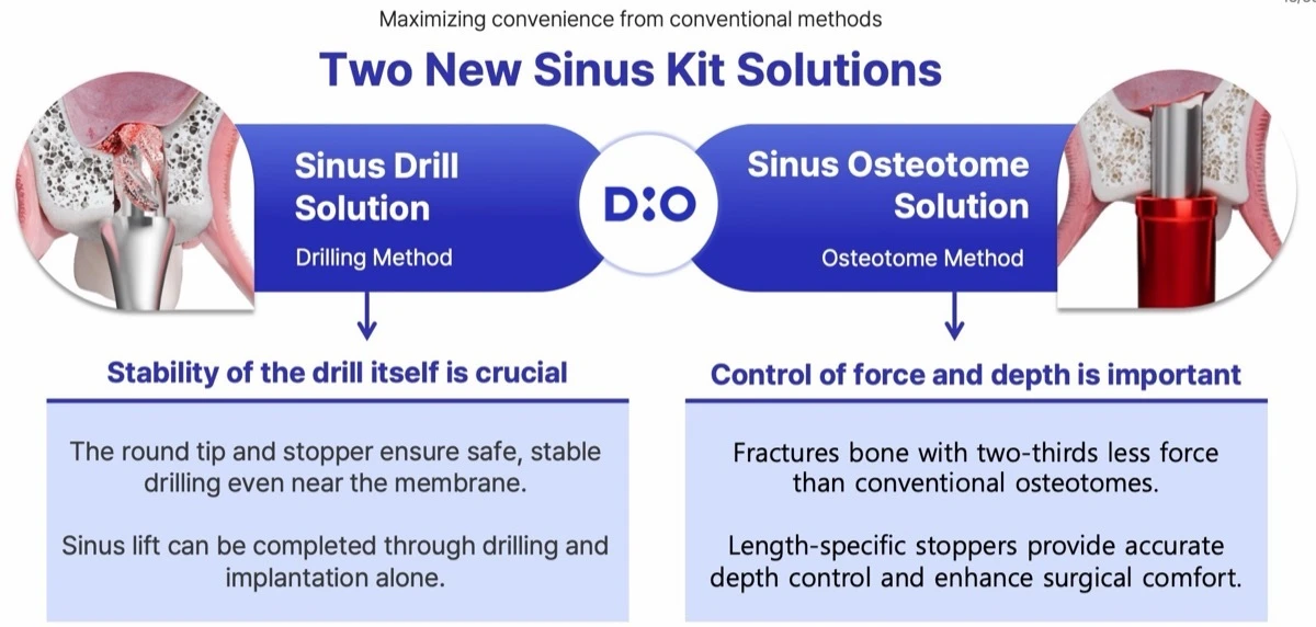 Two New Sinus Kit solutions: Drill Solution and Osteotome Solution