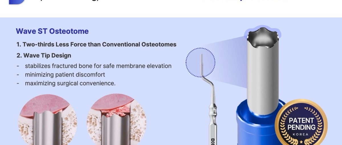 Wave ST osteotome with wave tip