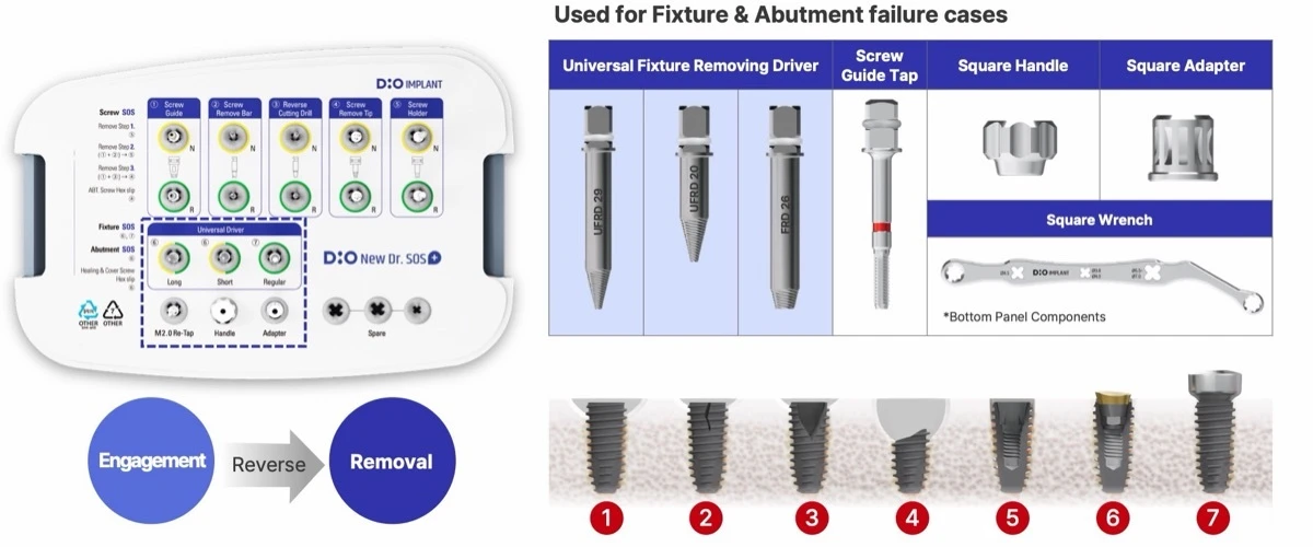 Dr. SOS+ fixture and abutment removal tools: engagement then reverse removal