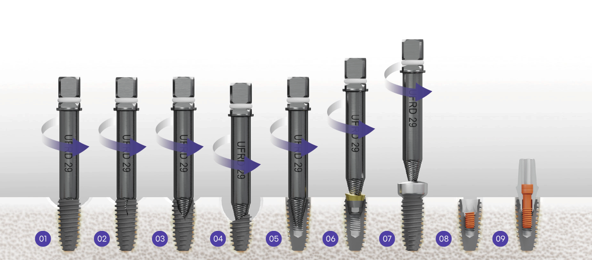 DIO Dr. SOS Plus Kit applications for fractured implants, abutments, damaged hexes, and screw complications