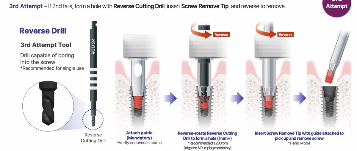 3rd attempt: Reverse Cutting Drill and Screw Remove Tip