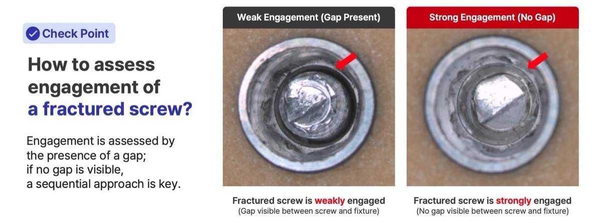 How to assess engagement of a fractured abutment screw