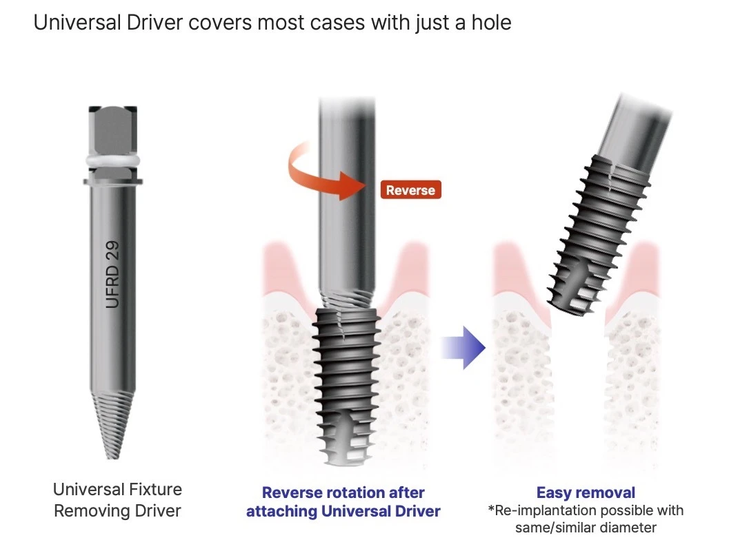 Universal Fixture Removing Driver: reverse rotation removes the fixture