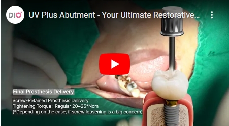 UV Plus Abutment - Your Ultimate Restorative Solution